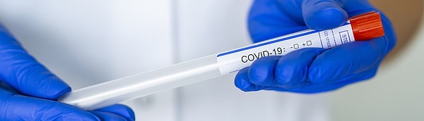 В журнале "Annals of Internal Medicine" были опубликованы детали исследования, в котором Университет Джона Хопкинса оценивал данные из 7 предыдущих исследований ПЦР-РВ-тестов, которые выявили наличие вируса.