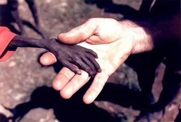 10. Uganda'da açlık çeken bir çocuğun eli, 1980.