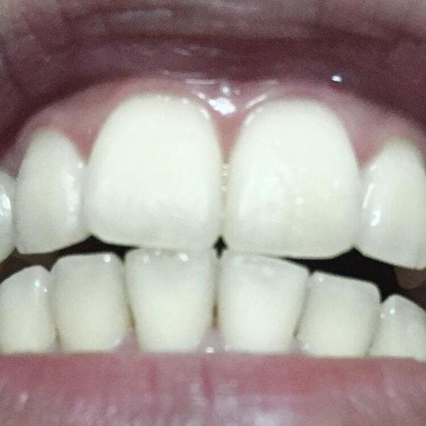 13. "Dişlerimin arasında boşluk ok gibi duruyor."