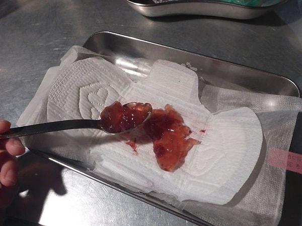 13. Обычное желе, ничего особенного