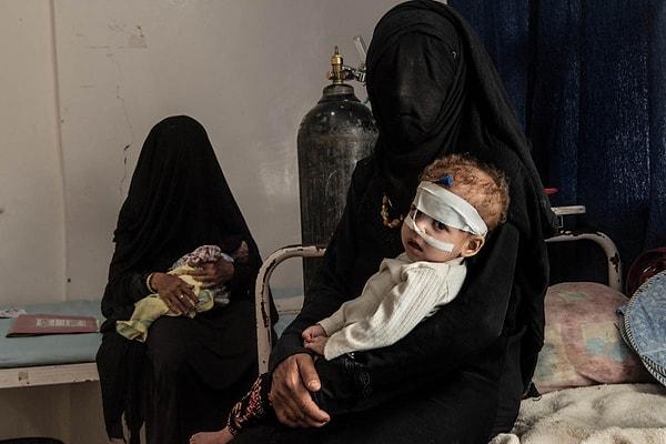 8. Bir anne ve çocuğu Saada'da bulunan bir hastanede. Yaşadıkları şehir bombalanmış.
