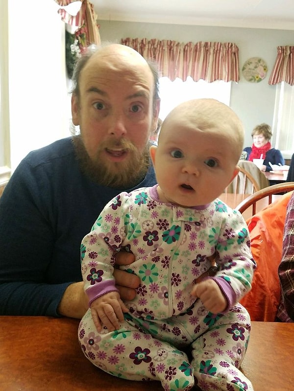 8. У нас с дочерью одинаковая ямочка на лбу