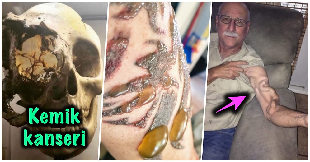 Bakmayı Başarsanız da Midenizi Kaldırıp Kalıcı Travma Yaşatacak İnternet Dehlizlerinden 16 Lanetli Görsel