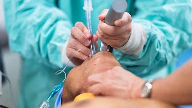 Göğüs Cerrahisi Anabilim Başkanı Prof. Dr. Sina Ercan, Covid 19 salgını sonrasında da entübasyona bağlı nefes borusu darlıkları (trakea stenozu) sorunlarıyla karşılaşılabileceğini söyledi.