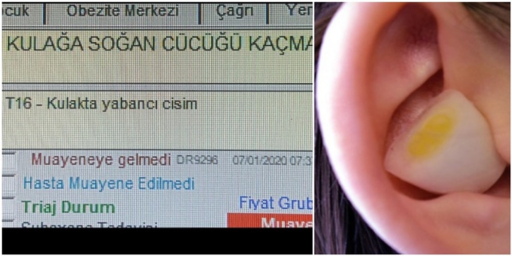 Hastanelerin Acil Servislerine Gelen Aşırı İlginç Hasta Şikayetlerini Öğrenince 'Yarabbi Şükür' Diyeceksiniz
