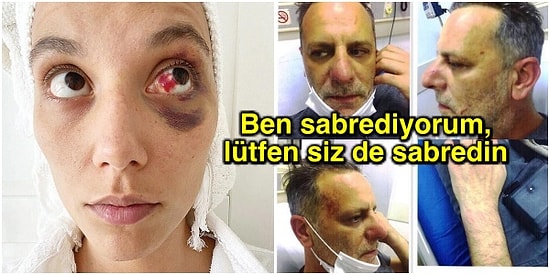 Ozan Güven, Deniz Bulutsuz Tarafından Darp Edildiğini İddia Ettiği Fotoğraflar Yayınlayarak Açıklama Yaptı