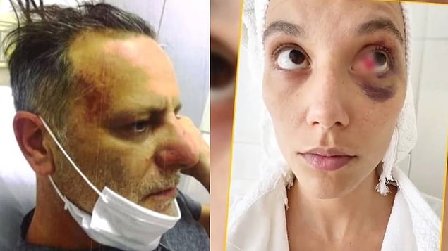 8. Ozan Güven'den şiddet gördüğü söylenen Deniz Bulutsuz'un avukatı, konuyla ilgili açıklama yaptı!