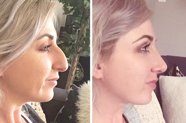 Önce her şey görece masum başladı. Normal kabul edilenden daha farklı fiziksel özelliklere sahip olduğunu düşünenler bıçak altına yatıyordu.