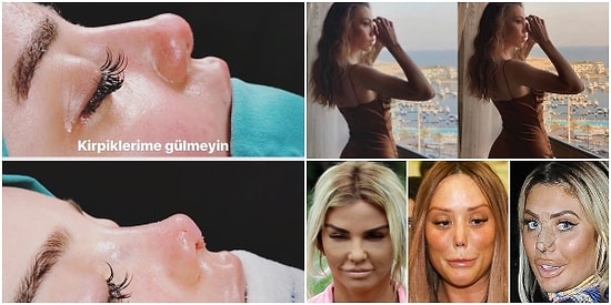 Estetik Operasyon Çılgınlığı Nereye Gidiyor? Asla Tatmin Olmayan Kusursuzluk Takıntısı ve Algımızda Yol Açtığı Sorunlar