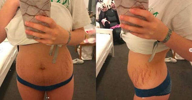"Doğum yaptıktan 15 gün sonra, vücudumun şu anki hali ve bugün tekrar spor yapmaya başladım. Karın kaslarımın tekrar düzelmesi için doğum sonrası bir rutine ve zorlayıcı egzersizlere başladım. "