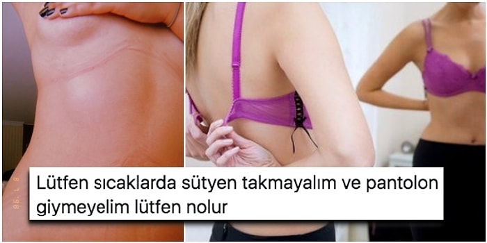 Bu Sıcakta Giydiği Sütyen ve Pantolonun Vücudunda Bıraktığı İzleri Paylaşan Kadının İsyanına Diğer Kadınlardan Destek Geldi