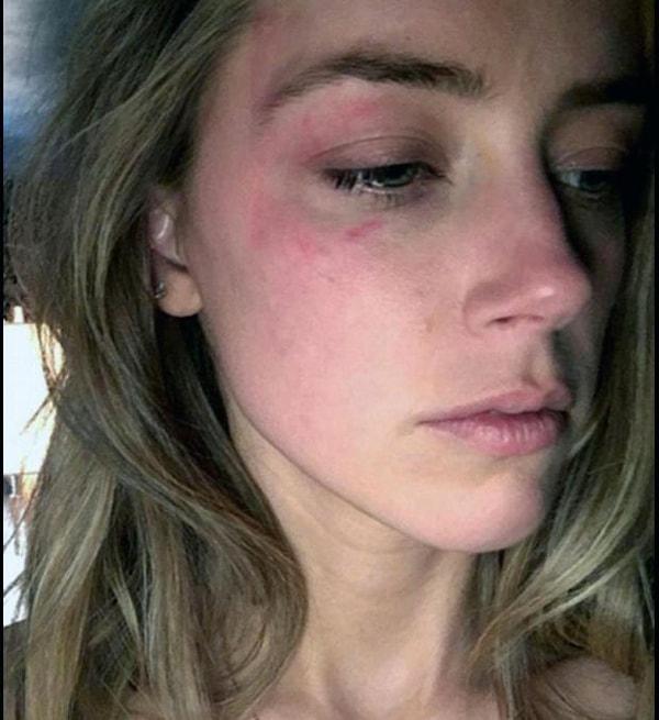 Amber Heard'ün ise Johnny Depp ile ilgili başka iddiaları da vardı. Heard, Depp'in kendisine telefonda köpek gibi uluduğunu ve daha sonra yüzüne vurduğunu söyledi.