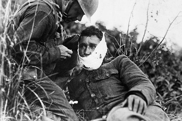 4. Birinci Dünya Savaşı sırasında bazı yerlerde korkaklık gösteren askerler vuruluyordu. Şimdilerde anlaşılıyor ki, bu askerler korku değil, travma sonrası stres bozukluğu yaşıyorlardı.