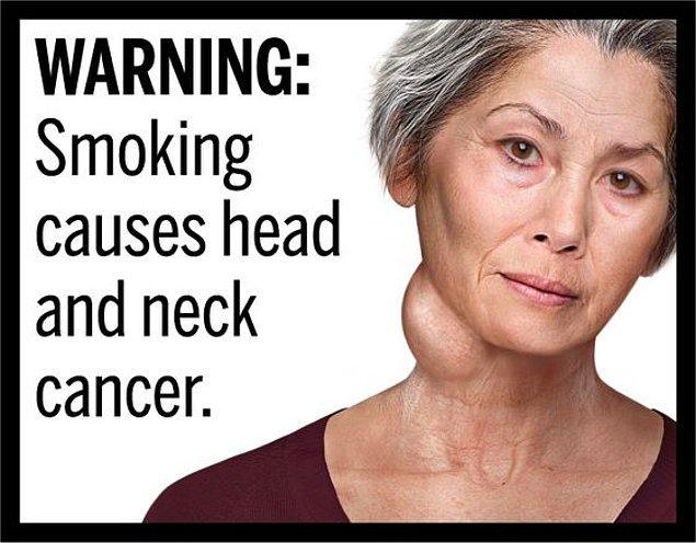 7. Sigara içmek baş boyun kanserine yakalanma riskinizi arttırır.