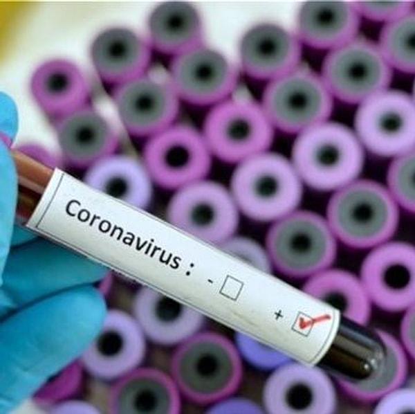 Ancak, bu yöntem birçok insanın koronavirüsü alabileceği ve hiçbir zaman semptom gösteremeyeceği netleştikten sonra güvenilirliğini kaybetti.