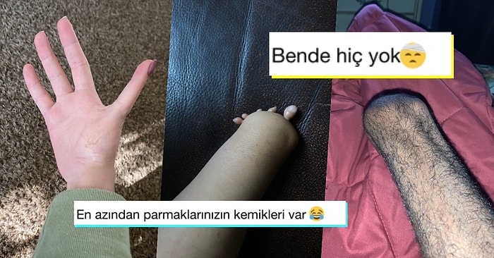 Twitter'da Bir Kadına Gelen Cevap Üzerine Parmaklarındaki Anomalileri Paylaşarak İlginç Bir Akıma İmza Atan Kişiler