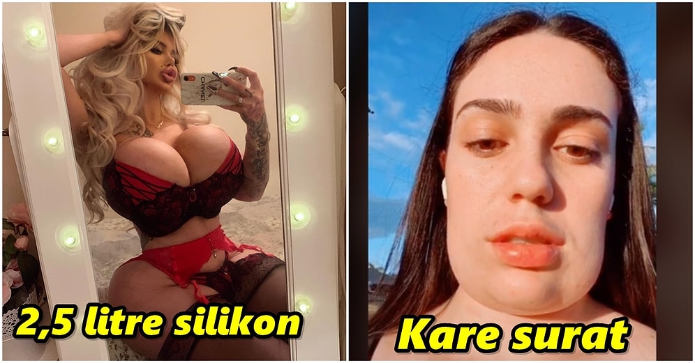 Yaptırdıkları Estetik Müdahaleler ile Plastik Cerrahların Hipokrat Yeminlerini Yırttıracak Bahtsız İnsanlar