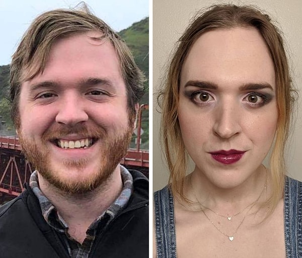 7. "После 2 лет гормональной терапии."