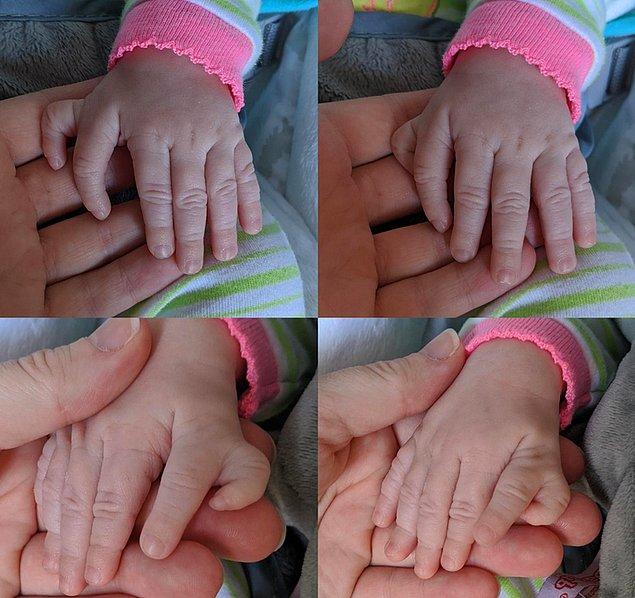 11. 'Şubatta doğan en küçük kızımın her iki elinde de ekstradan bir parmak var.'