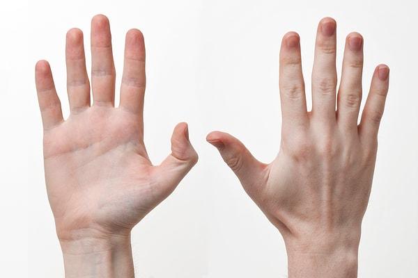 5. Kopan el baş parmakları ayak parmaklarıyla değiştirilebiliyor.