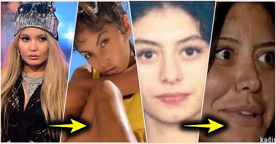 Tıbbın Sunduğu Tüm İmkânlardan Yararlanmalarına Rağmen Estetik Mağduru Olmaktan Kurtulamayan Ünlüler