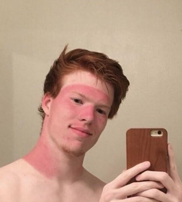 6. "Теперь моя кожа в тон моим волосам"