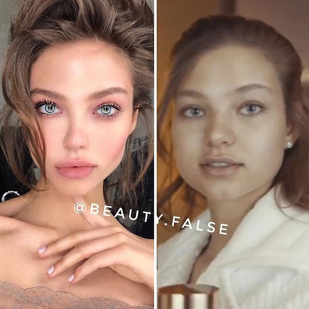 7. Jawline ameliyatına gerek mi var, photoshop varken...