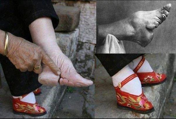 1. Çin'in enteresan bir güzellik trendi olan minik ayaklarla başlayalım.