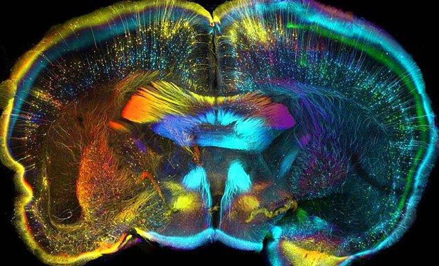 14. Bir farenin beyninden alınan parçanın mikroskop altındaki görüntüsü.