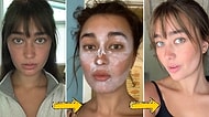 Dikkat, Evde Denemeyin: TikTok İle Popüler Hale Gelen ve Dermatologların Kesinlikle Önermediği Güzellik Trendleri