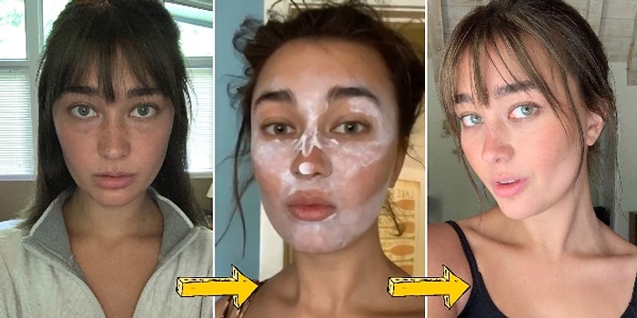 Dikkat, Evde Denemeyin: TikTok İle Popüler Hale Gelen ve Dermatologların Kesinlikle Önermediği Güzellik Trendleri