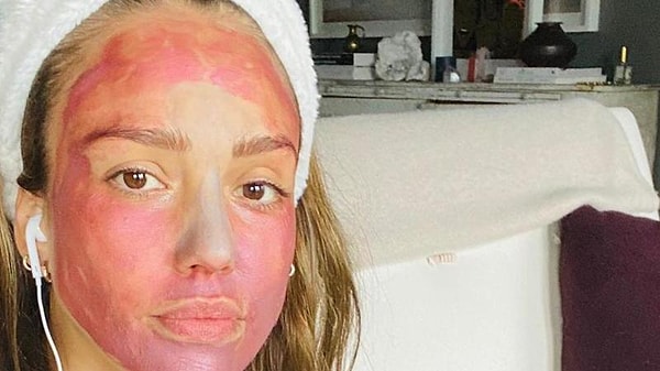 В погоне за красотой вы можете нанести большой вред своей коже.