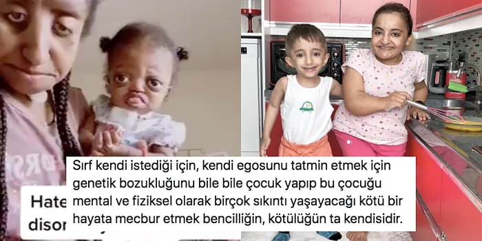 Ego Tatmini mi? Genetik Bozukluğu Olmasına Rağmen Engelli Çocuklara Sahip Olan İnsanlara Yapılan Eleştiriler