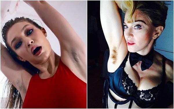 Kadınların vücutlarında bulunan kılları almaması yeni bir durum değil. Kılları almanın, toplumun dayattığı bir güzellik algısı olduğunu düşünenler uzun zamandır bu tartışmanın içinde. Hatta ünlü model Gigi Hadid ve Madonna da bu akıma destek verenlerden.