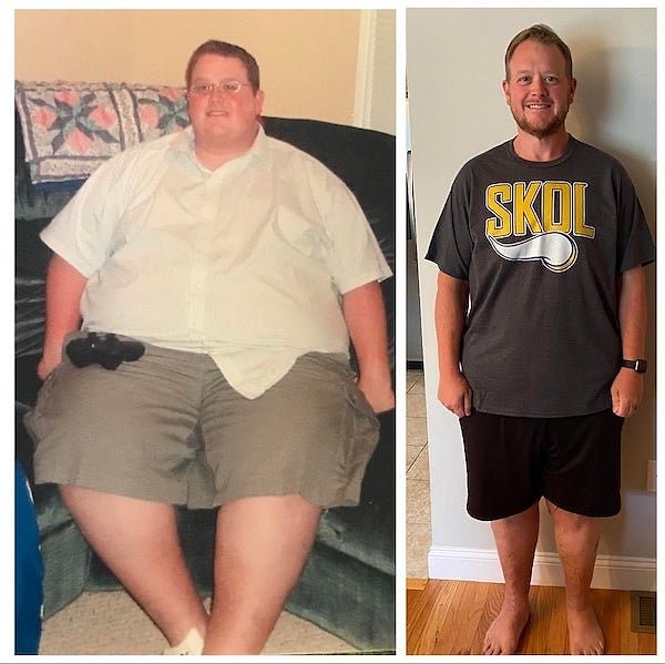 16. «Я делюсь этой фотографией, чтобы любой, кто нуждается в этом, знал, что похудеть можно».