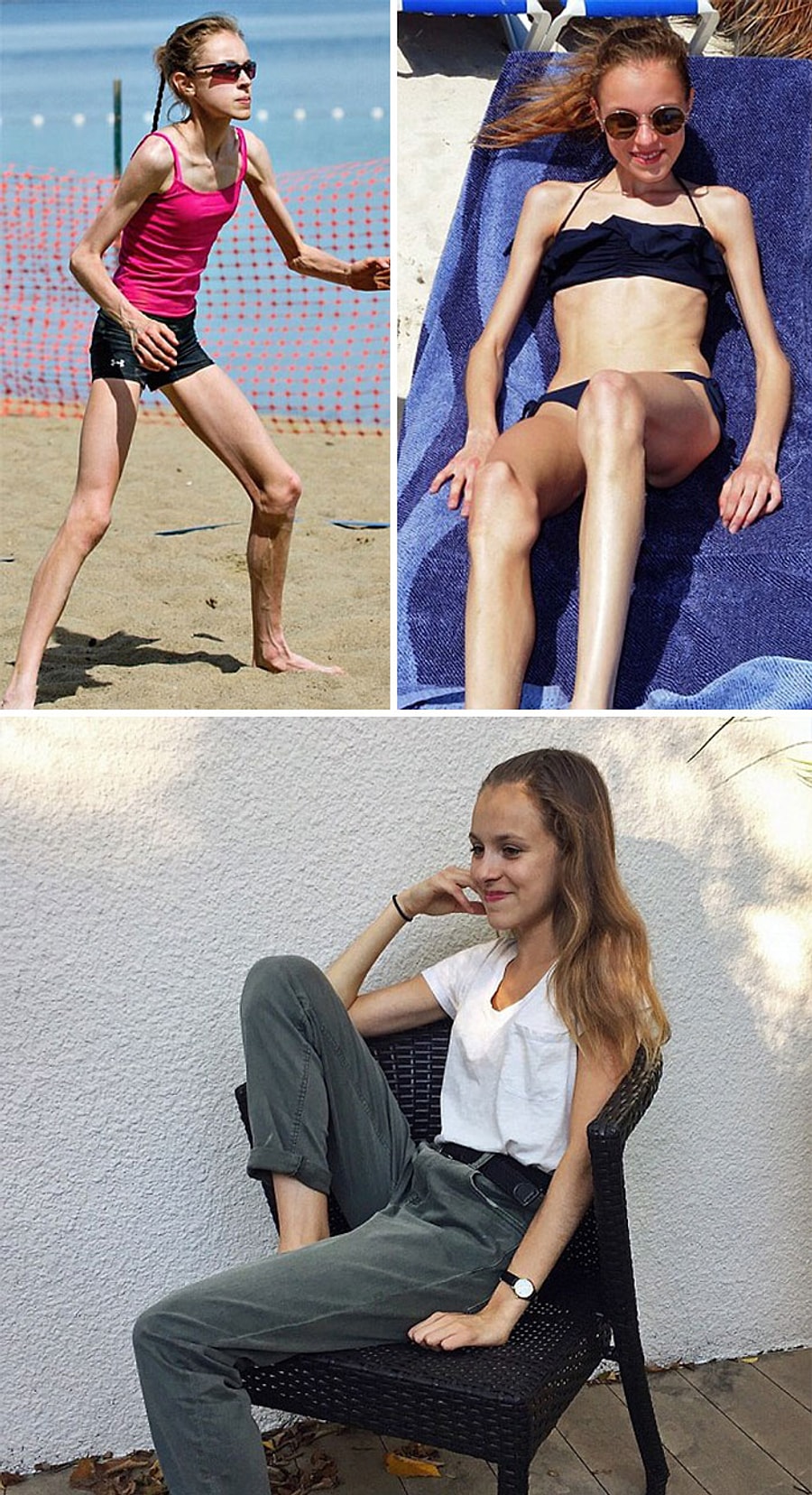 Как не стать худой. Девушки до и после анорексии. Худые девушки. Кейт мосс героиновый шик фотосессия. Диеты знаменитых моделей.