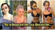 Anoreksiya Hastalığını Yenip Kilo Alarak Bambaşka Biri Gibi Gözüken 21 Kişi