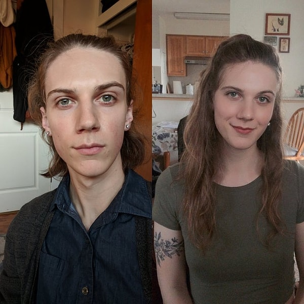 2. "Tedavinin başında hiçbir şey değişmemiş gibi hissediyor insan ama sabırlı olun. Hormon tedavisine başladıktan 27 ay sonra."