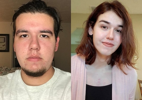 7. "Soldaki hayatımın en kötü günleriydi, sağdaki ise bugün ben."