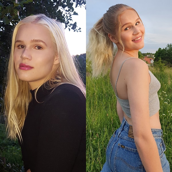 16. "Hormon tedavisindeki ilk günüm vs 2 yıl sonra!"