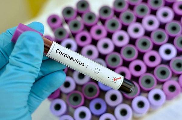 Koronavirüsle alakalı birçok çalışma yayınlandı, bunlardan biri de birkaç gün önce Uluslararası Doktorlar Derneği'nin yayınladığı En Riskli Koronavirüs Aktiviteleri çalışması...