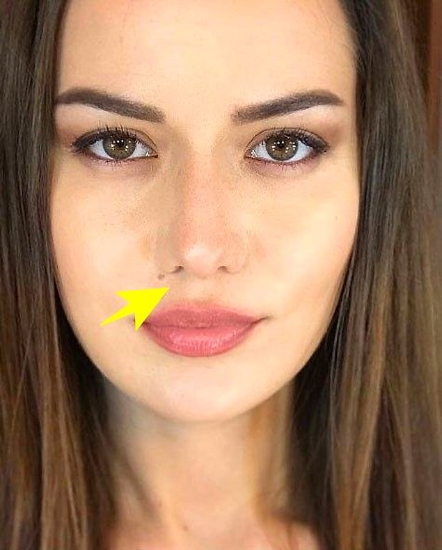 Peki siz bu 'lip lift' işlemi hakkında ne düşünüyorsunuz? Sizce bu ünlülerde 'lip lift' işlemi var mı? Fahriye: