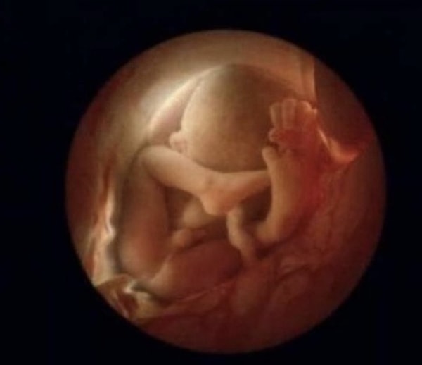 13. Ребенок в утробе матери
