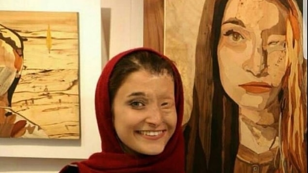 Bir diğer asit saldırısı kurbanı ise Massoumeh Attaie. Yüzünün yarısını işlevsiz bırakan acımasız saldırıyla ilgili hiçbir zaman adalet bulamayanlardan.