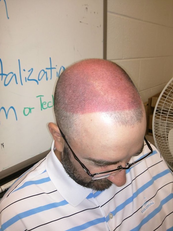 12. Коллега побрил голову, потом пошел играть в гольф и решил надеть козырек