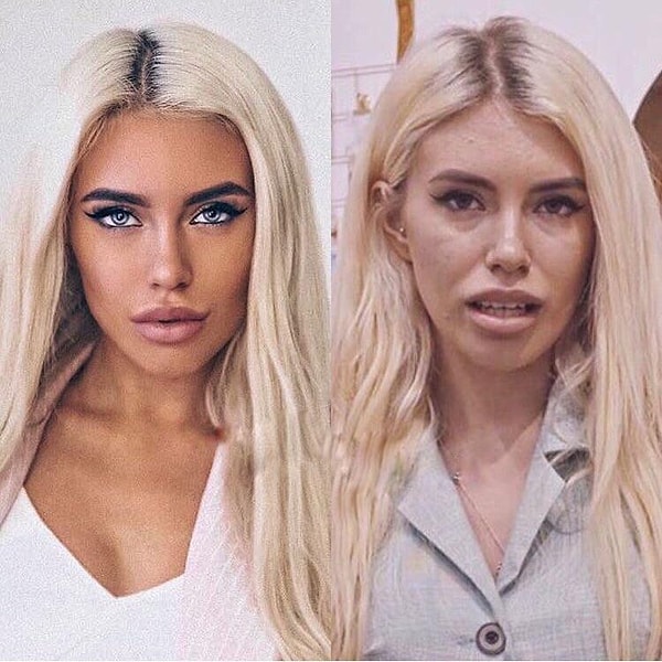 Идеальное восприятие красоты и давление, создаваемое культурой социальных сетей, представляют собой большую проблему, особенно для молодых людей.