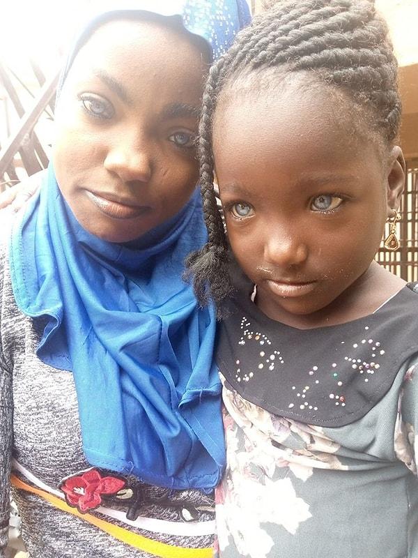 İki çocuk annesi Risikat, Nijerya ve Afrika'da nadir görülen mavi gözlerle çile çekmesine rağmen bu durumdan mutlu olduğunu dile getiriyor.