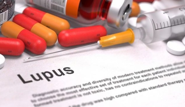 Aslında bu yazıda Lupus hastalığını değil, Lupus hastalarına karşı farkındalığı anlatacağız...