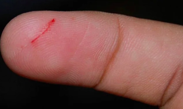 14. "Elime bıçak almadığım, keskin hiçbir şeyle uğraşmadığım halde parmaklarım:"