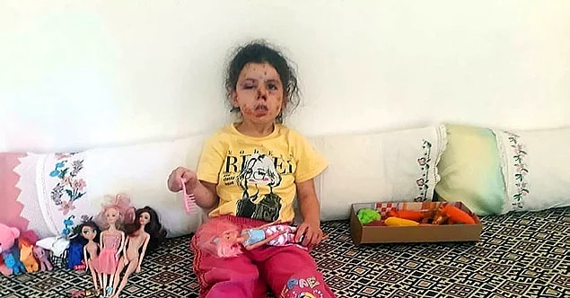 6. Düğün konvoyunda açtıkları ateşle 5 yaşındaki Neriman'ı yaralayanların adli kontrolle serbest kalması...